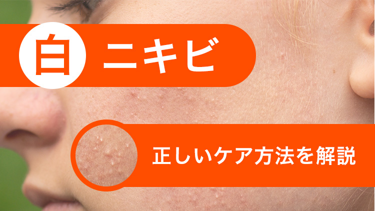 白ニキビを一晩で治す方法はある?正しいケア方法を解説!|ANS. magazine