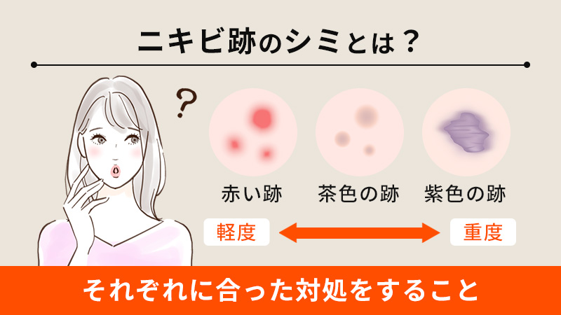 ニキビ跡のシミとは？シミになるニキビ跡の種類や治療法を解説