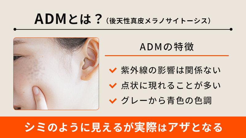 ADMとは