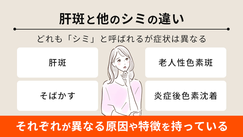 肝斑と他のシミの違い