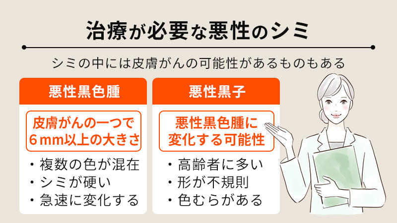 治療が必要な悪性のシミとは