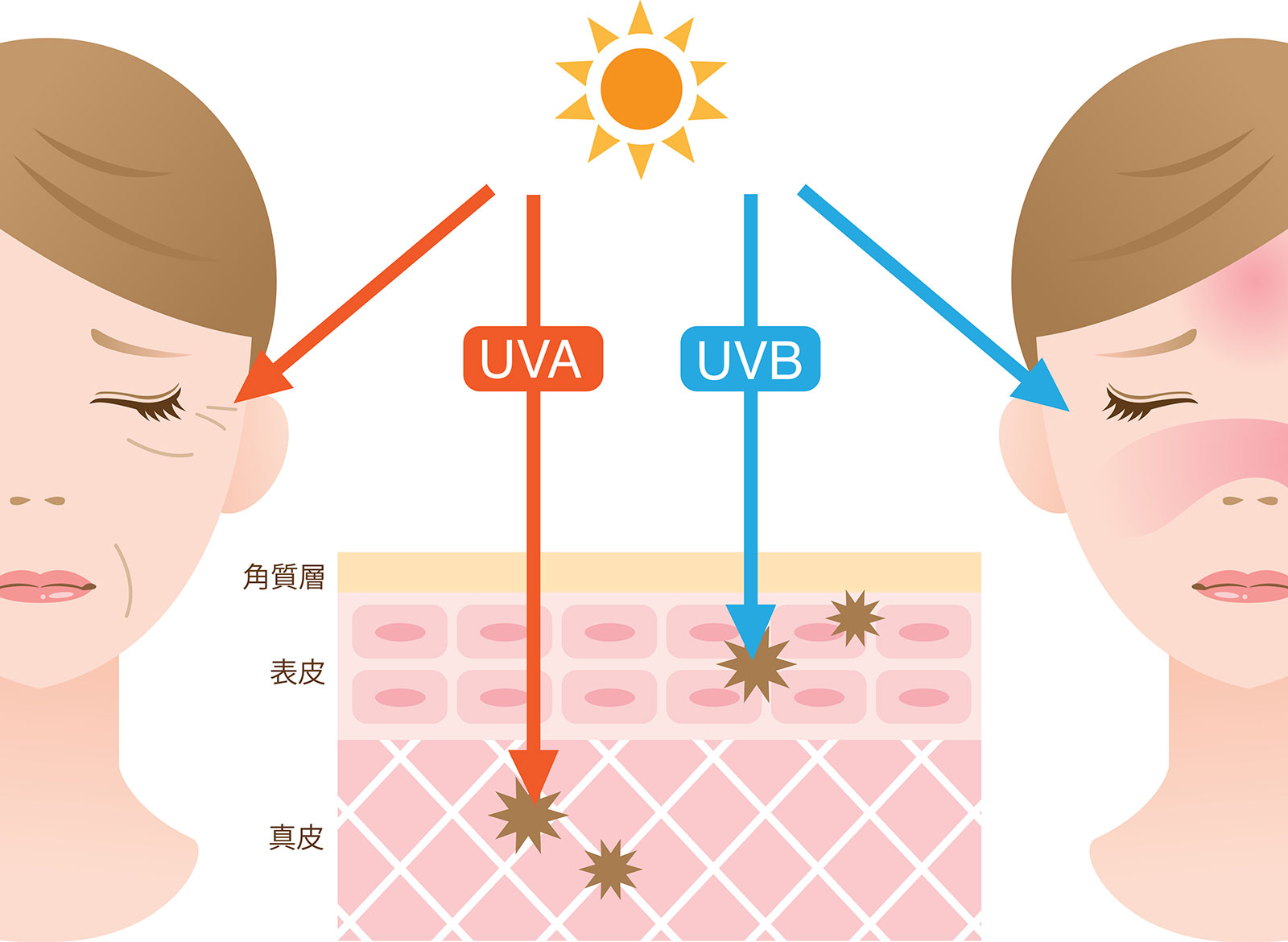 紫外線による肌ダメージの仕組み