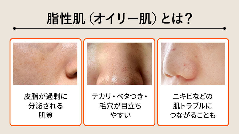 脂性肌（オイリー肌）とは？