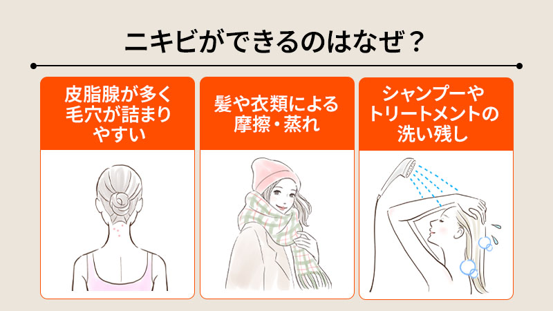うなじにだけニキビができるのはなぜ？