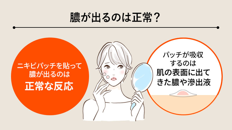 ニキビパッチで膿が出るのは正常？まず知っておきたい仕組み