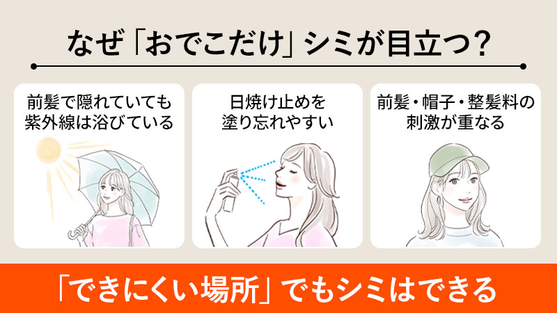 なぜ「おでこだけ」シミが目立つことがあるのか