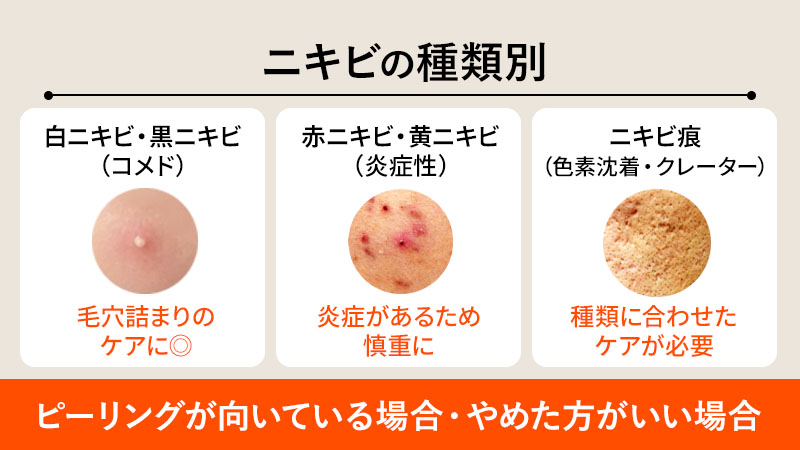 ニキビの種類別｜ピーリングが向いている場合・やめた方がいい場合