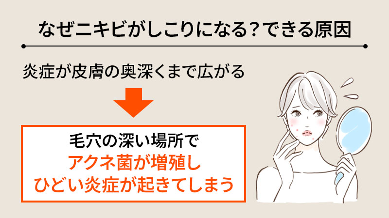 なぜニキビがしこりになる？できる原因