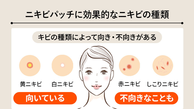そもそもニキビパッチに効果的なニキビの種類