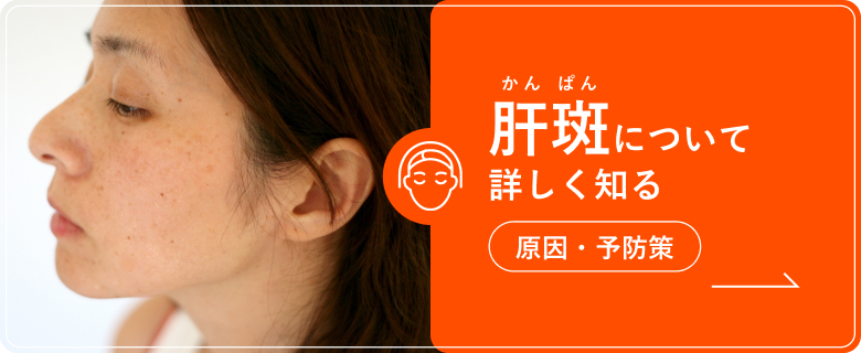 肝斑について詳しく知る|原因・予防策
