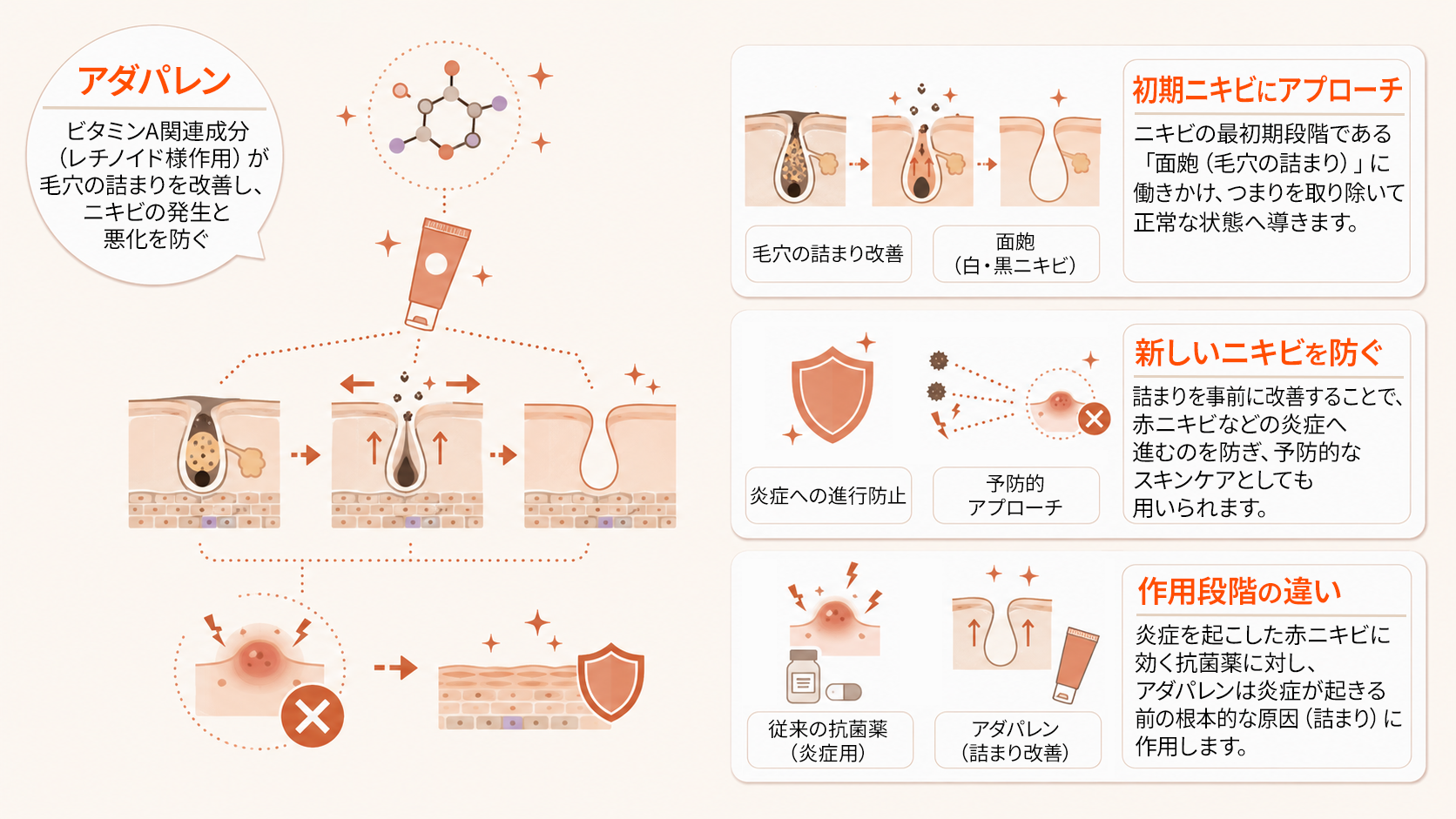 アダパレンが働きかけるニキビの初期段階