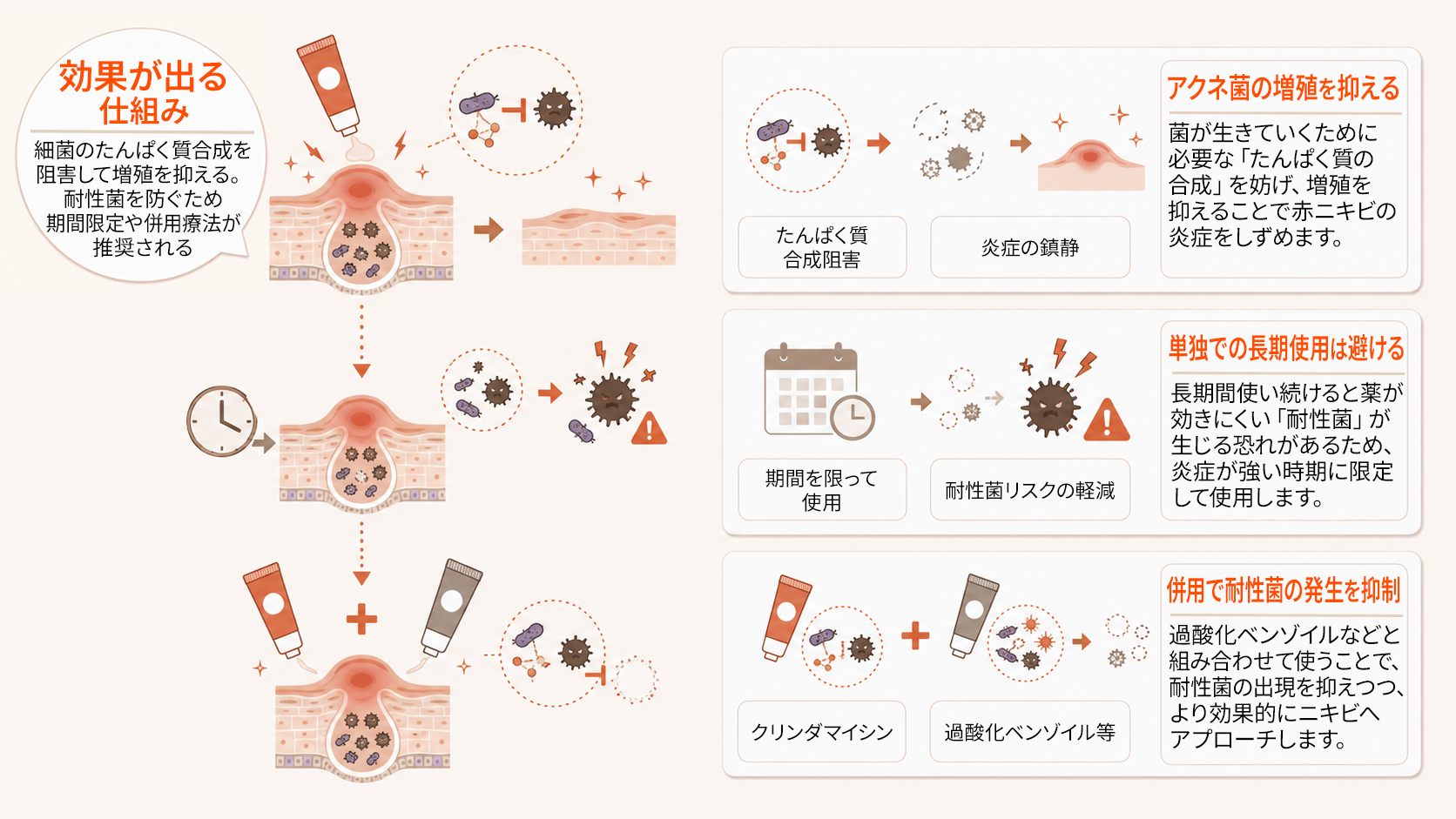 クリンダマイシンの作用機序と耐性菌の問題